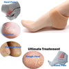 Heel Pad For Heel Pain Heel Socks Anti Crack Silicon Gel Heel And Foot Protector Moisturizing Socks